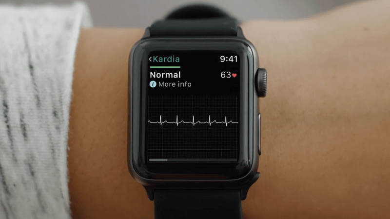 Apple Watch can detect diabetes with 85% accuracy