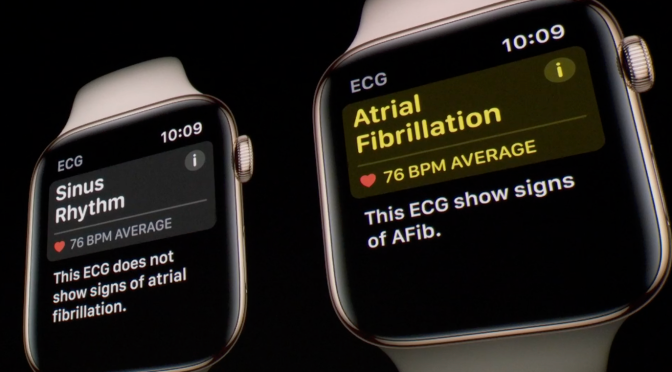 Apple Watch ECG impresses doctor by diagnosing premature ventricular contraction of patient