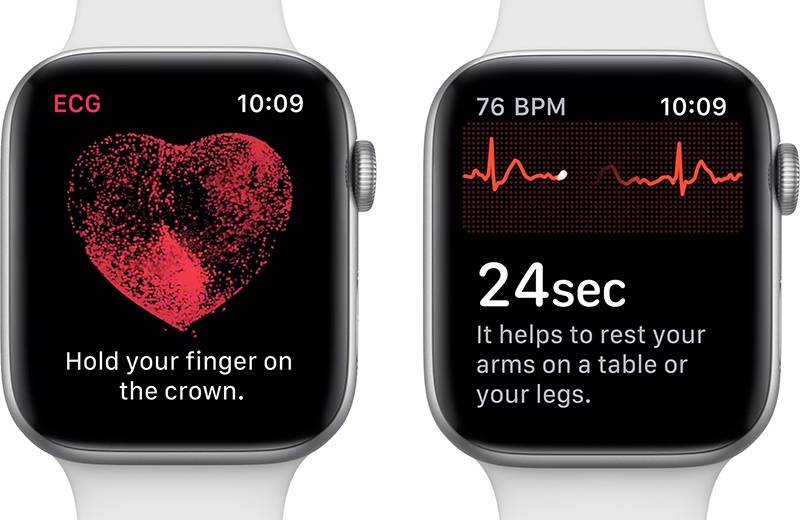 apple-watch-ecg