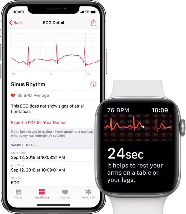 apple-watch-ecg-readings